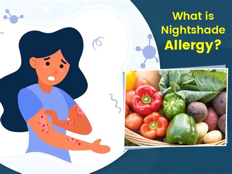 Nightshade Allergy: Read To Know How Vegetables And...