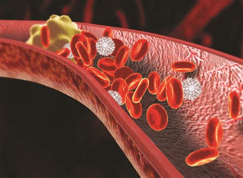 Promoting safe use of parenteral anticoagulants - American Nurse