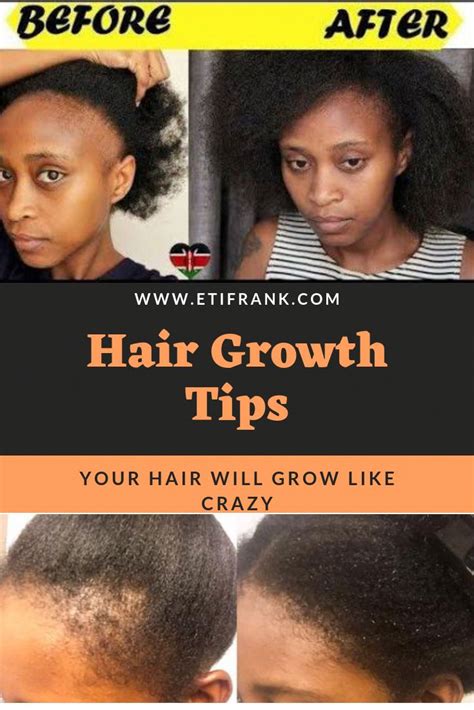 15 Unbelievable Hair Growth Products For Women Hair Growth Jamaican ...