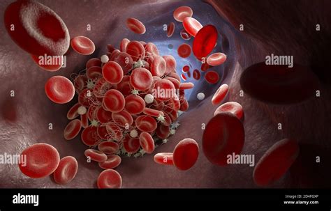 Coagulated blood hi-res stock photography and images - Alamy