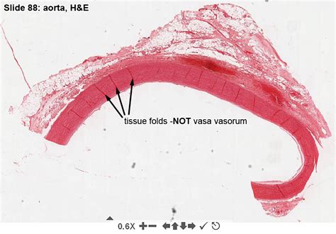 Interventricular Septum Histology