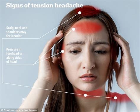 Not all headaches feel the same, handy picture guide shows | Daily Mail Online