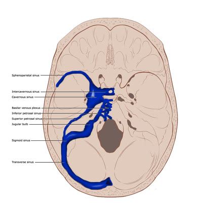 Sigmoid Sinus