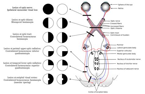 2016-07-10 | Visual cortex, Human anatomy and physiology, Optic neuritis