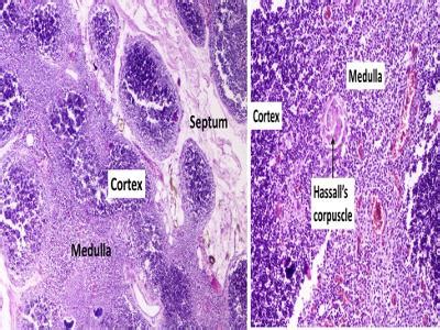 Thymus Gland Slide Labeled