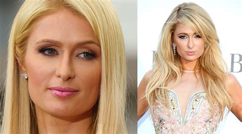 Paris Hilton Nose Job Plastic Surgery Before And After Rhinoplasty Photos | 2018 Plastic Surgery ...