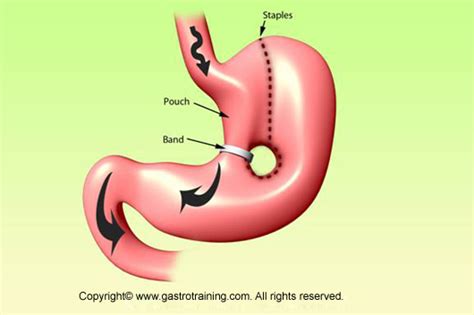 Gastroenterology Education and CPD for trainees and specialists ...