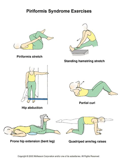 Piriformis Syndrome