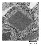 Peroxisome Structure and Function and Peroxisome associated diseases