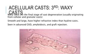 Urine casts | PPT