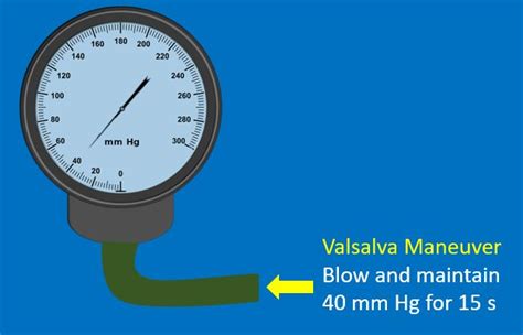 Role of Valsalva maneuver in cardiology – All About Cardiovascular ...