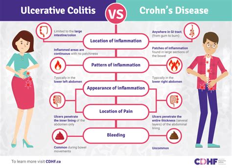 Inflammatory Bowel Disease Digital Toolkit for the Newly Diagnosed - Canadian Digestive Health ...