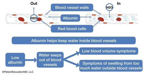 Albumin Levels