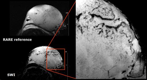 Mouse MRI CryoProbe | Bruker