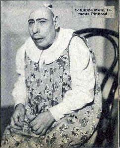 Schlitzie - Wikipedia