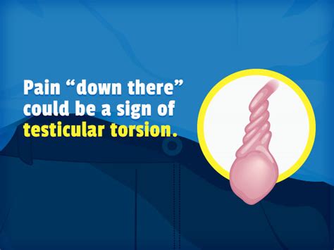 Testicular Torsion (for Teens) | Nemours KidsHealth