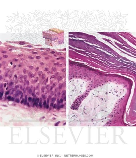 Light Micrograph of Nonkeratinized Stratified Squamous Epithelium In ...