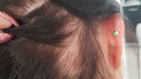 Traction Alopecia: How to Prevent and Fix It - Allure