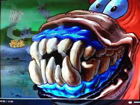Patrick's ugly Teeth