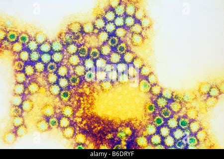 Feline Calicivirus (TEM Stock Photo - Alamy