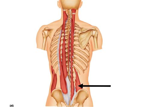 Lower Back Pain: Check Your Quadratus Lumborum Muscles | Online Health Mag