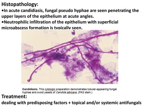 Cutaneous candidiasis photos: Pictures of Fungal Skin Diseases and Problems – Candidiasis ...