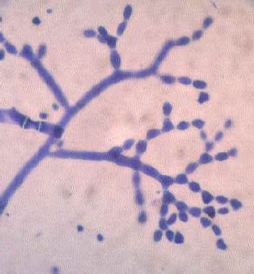 Identity of this fungi with clearer microscopic images, Neurospora fungi? | ResearchGate