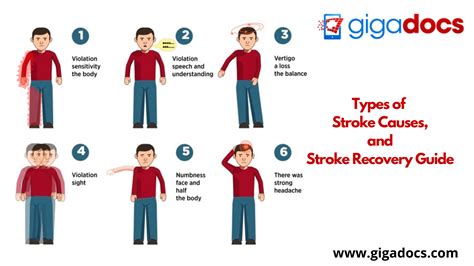 Causes Of Stroke Chart