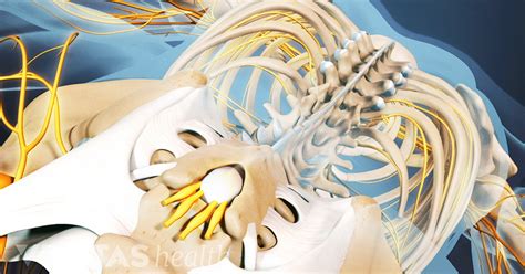 HLA-B27 Gene Definition | Defined by Arthritis-Health