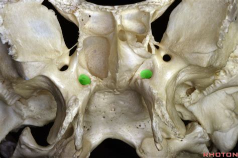 NASBS on Twitter: "#NASBS #Anatomy #Rhoton The highlighted structure below transmits which of ...