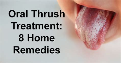 Oral Thrush Treatment: 8 Home Remedies - David Avocado Wolfe