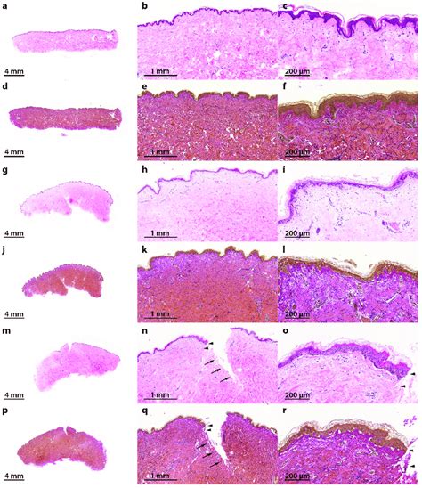 Hematoxylin-eosin (HE) and Elastica-van-Gieson (EvG) staining of... | Download Scientific Diagram