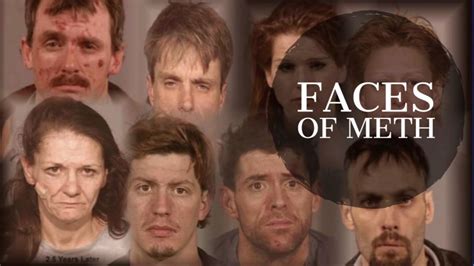 PHOTOS: How methamphetamine destroys your face and physical appearance - ABC13 Houston