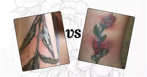 Normal Tattoo Scabbing Vs Infection