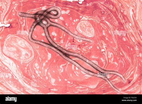 Ebola virus under microscope hi-res stock photography and images - Alamy