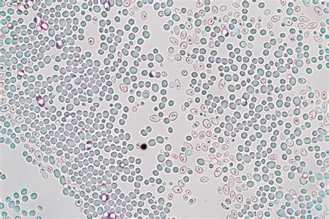 What Does Yeast Look Like Under a Microscope? (With Pictures!) - Optics Mag