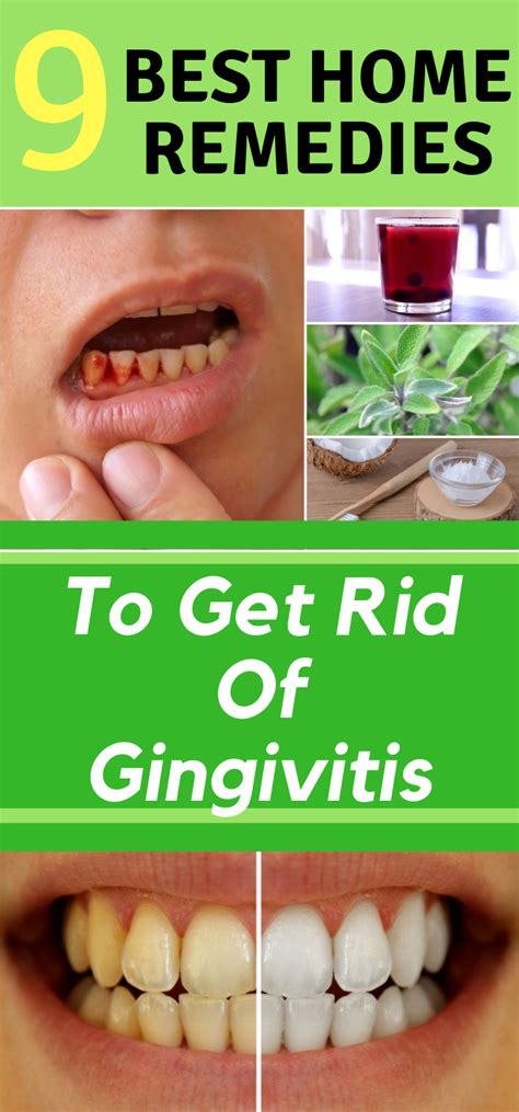 Run Healthy Lifestyle: 9 Best Home Remedies To Get Rid Of Gingivitis