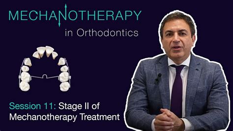 Mechanotherapy in Orthodontics Vol II: Stage II of Mechanotherapy Treatment #011 - YouTube