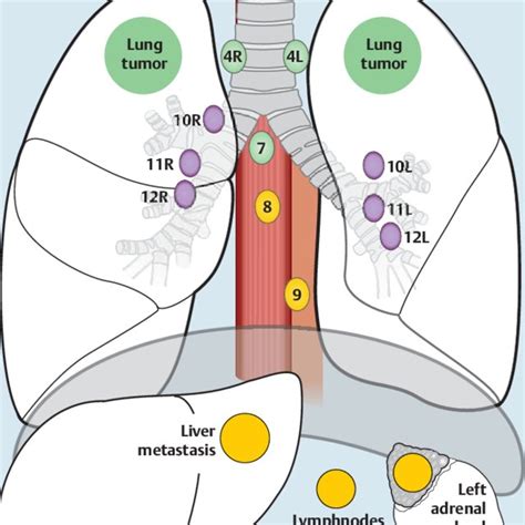 Hilar Lymph Nodes Map