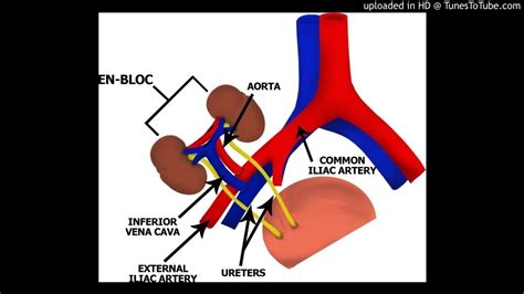 Pediatric Renal Transplantation - YouTube