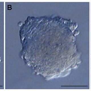 Generation of neurospheres from human neural precursors cells isolated ...