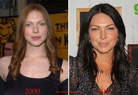 Laura Prepon - Plastic Surgery - Laura Prepon Photo (36204317) - Fanpop