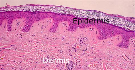 Dermis layers - Structure of dermis | the dynamic natural skin care