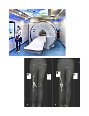 CT scan for scanogram | cost @1799/- | Medintu