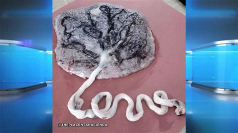 The Umbilical Cord Art Trend – Touching or Too Much?