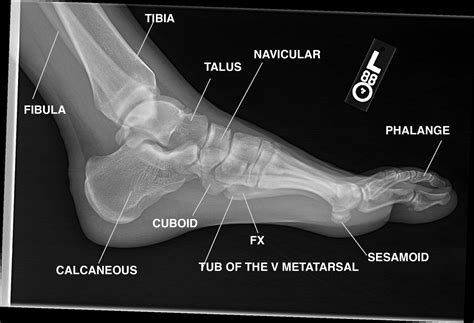 Pin by 👑Shayma👑 on Bones | Radiology student, Medical ultrasound, Foot anatomy