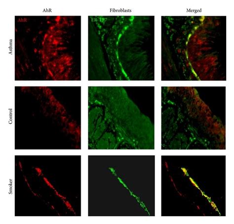 AhR expression in human airway. Immunofluorescence analysis of AhR ...