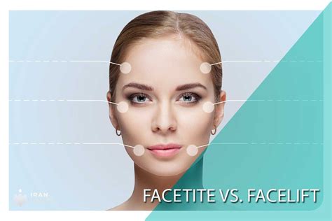 FaceTite Vs. Facelift: Which One Gives Better Results? | Iran Health Agency