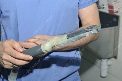 Prostate biopsy ultrasound equipment - Stock Image - C001/8057 ...