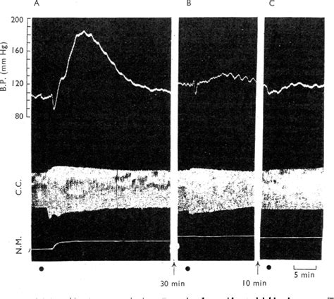 Figure 1 from Mechanism of the initial adrenergic effects of bretylium and guanethidine ...